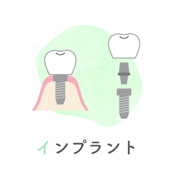 インプラント
